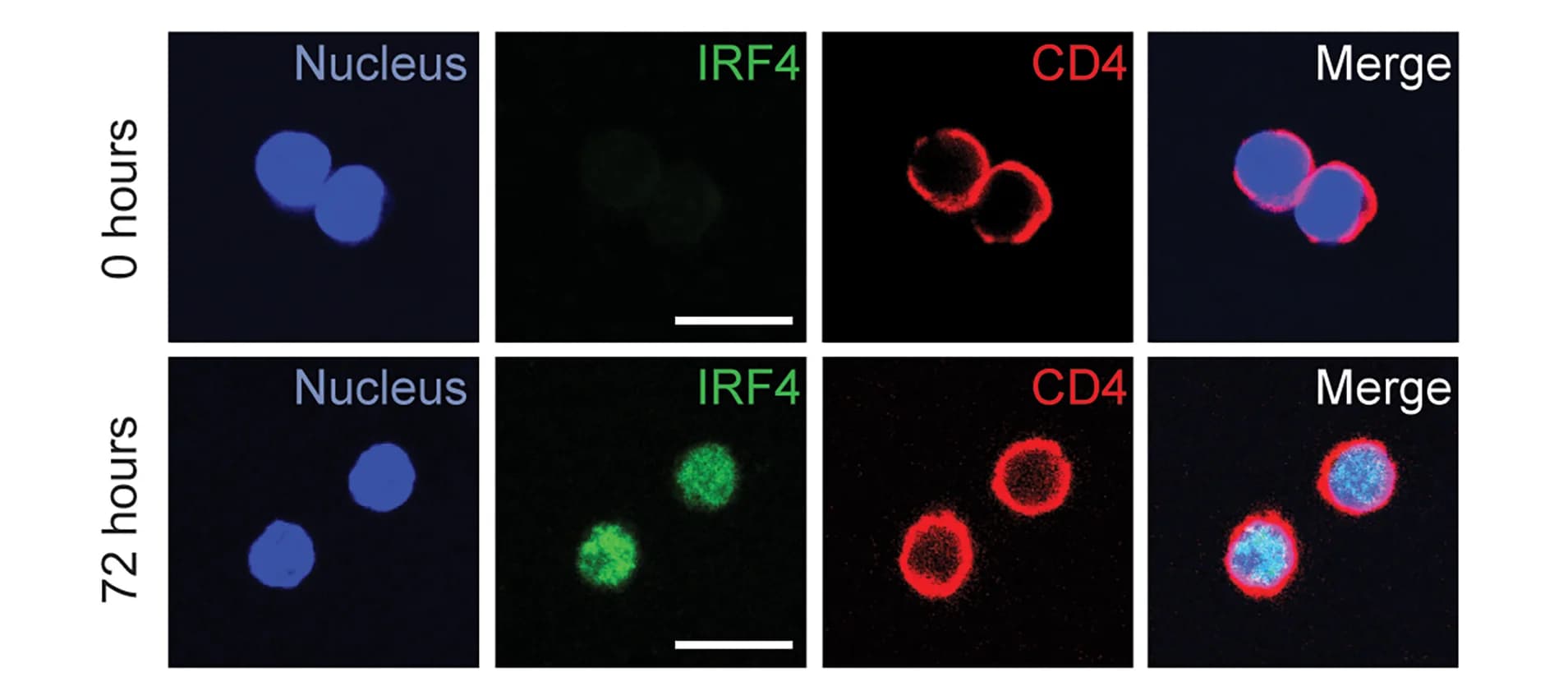 Open access visualization of Microscopy, CD4Th17 Cells, IRF4, Nuclear Expression, Differentiation