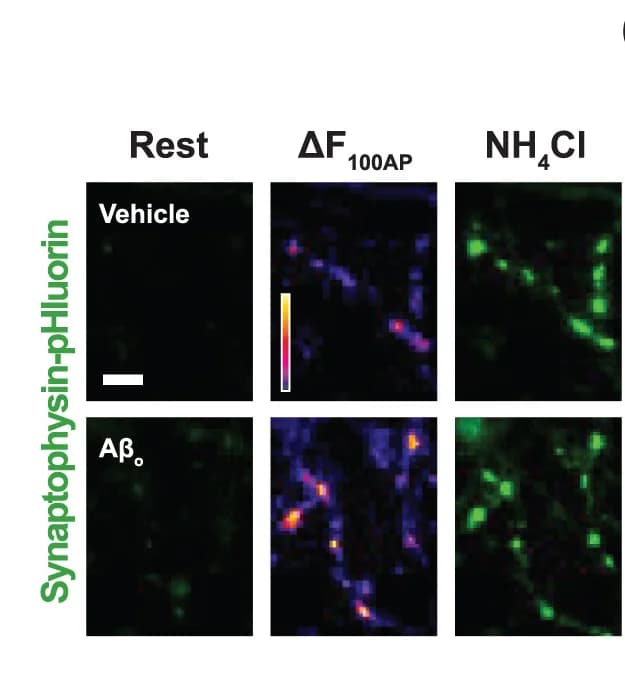 Open access visualization of Microscopy, Hippocampal Neuronal Boutons, Synaptophysin-pHluorin, Fluorescence, Stimulation