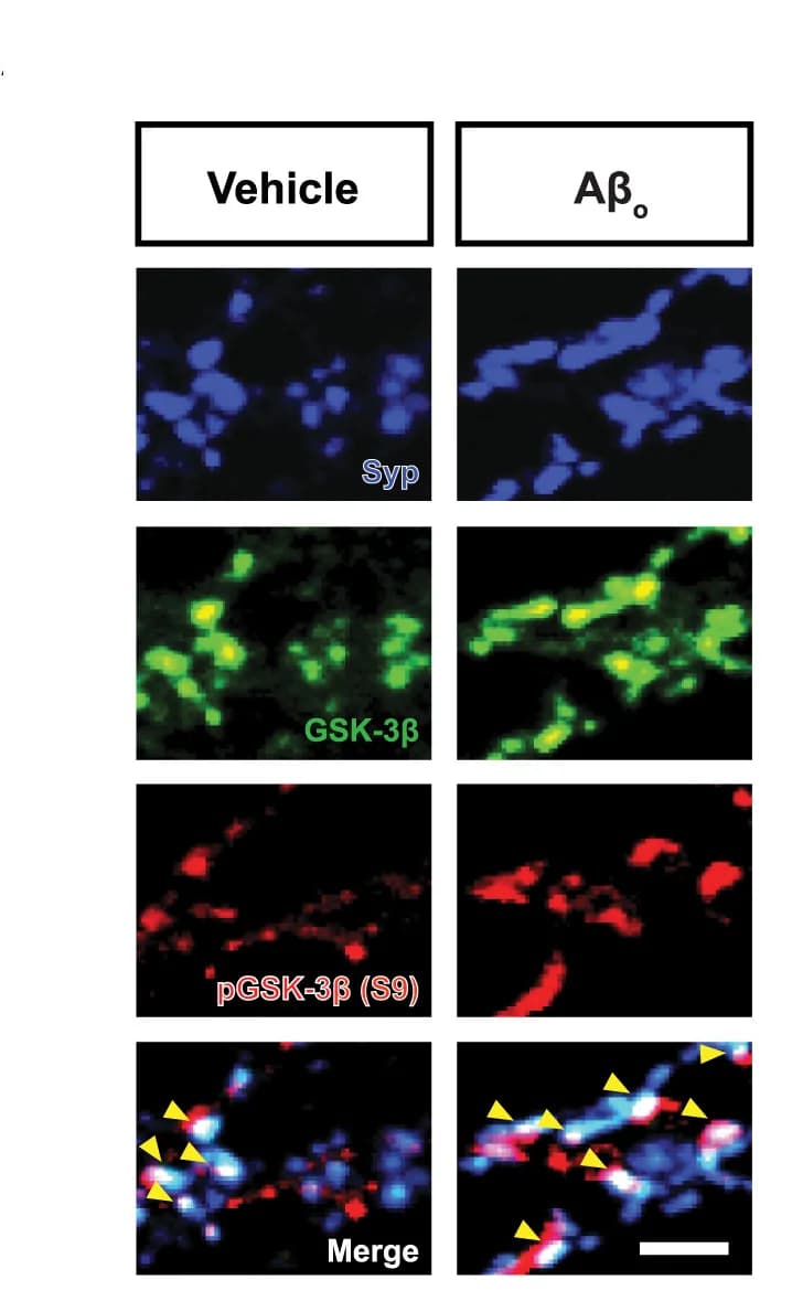 Open access visualization of Microscopy, Immunofluorescence, GSK-3beta, Synaptophysin, Presynaptic Terminal
