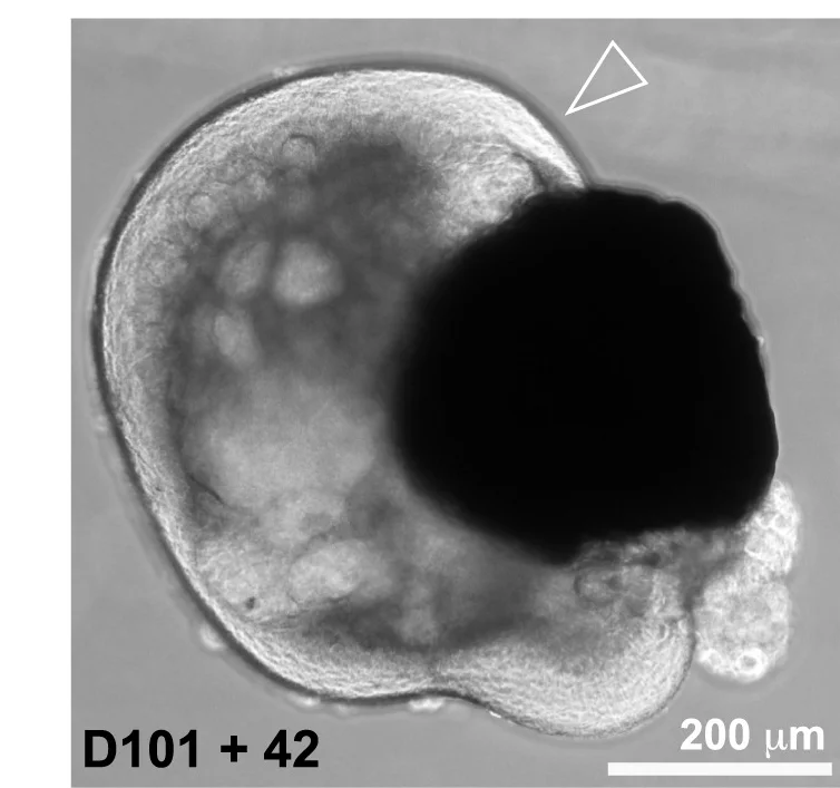 Open access visualization of Microscopy, Retinosphere, Far-Peripheral, Ciliary Body, Brightfield