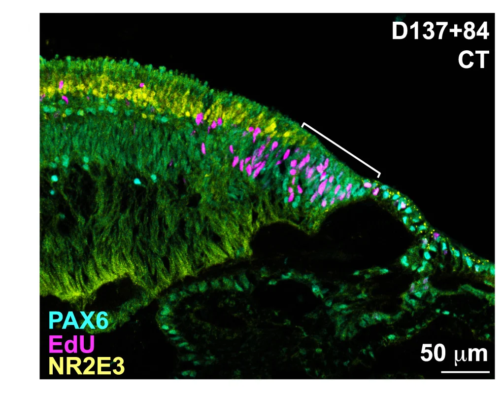Open access visualization of Microscopy, Retinospheres, CMZ, PAX6, EdU