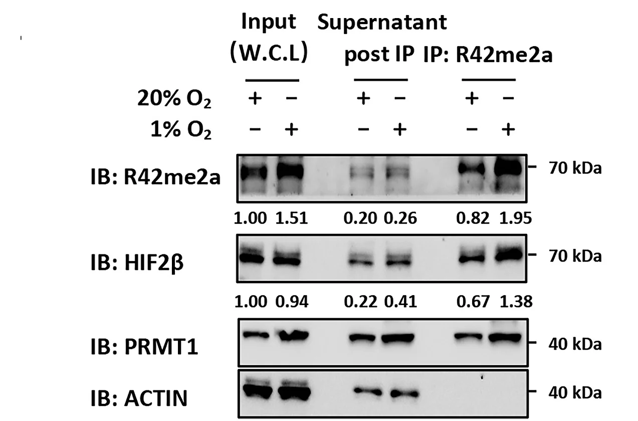 Open access visualization of Gel, MCF7 Cells, Normoxia, Hypoxia, Immunoprecipitation