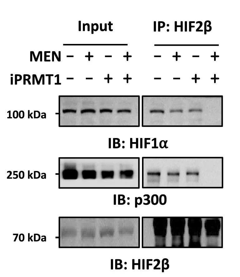 Open access visualization of Gel, MCF7 Cells, MEN, iPRMT1, Immunoprecipitation