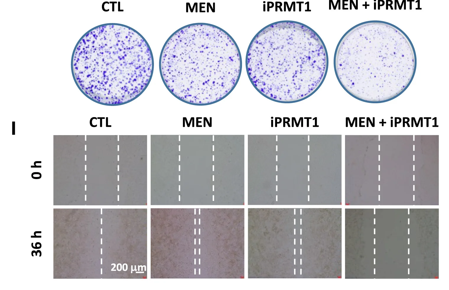 Open access visualization of Microscopy, Photo, MCF7 Cells, MEN, iPRMT1