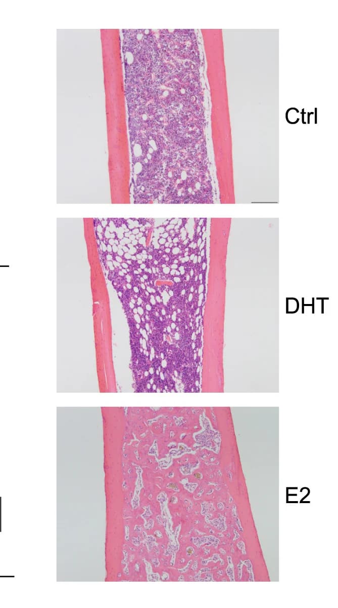 Open access visualization of Microscopy, Estradiol, Bone Marrow, Cellularity, Androgen