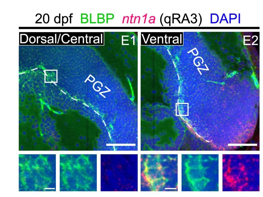 Open access visualization of Microscopy, In Situ Hybridization, qRA Subtype, Marker Genes, BLBP Immunostaining