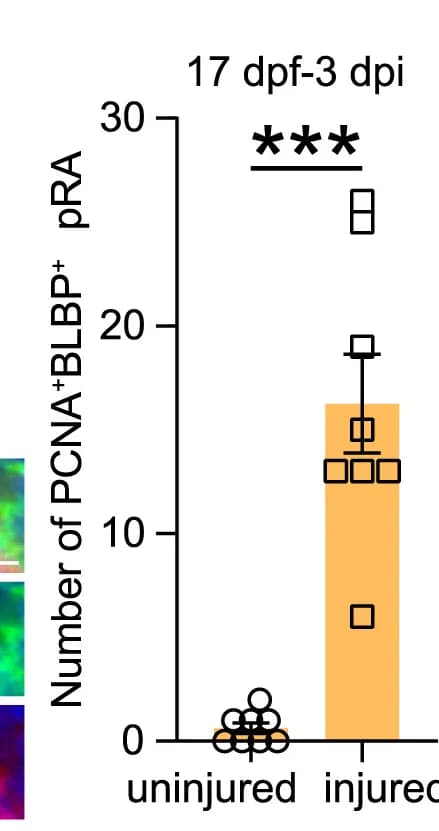Open access visualization of Bar Plot, Error Bars, Quantification, Proliferative Radial Astrocytes, Central OT