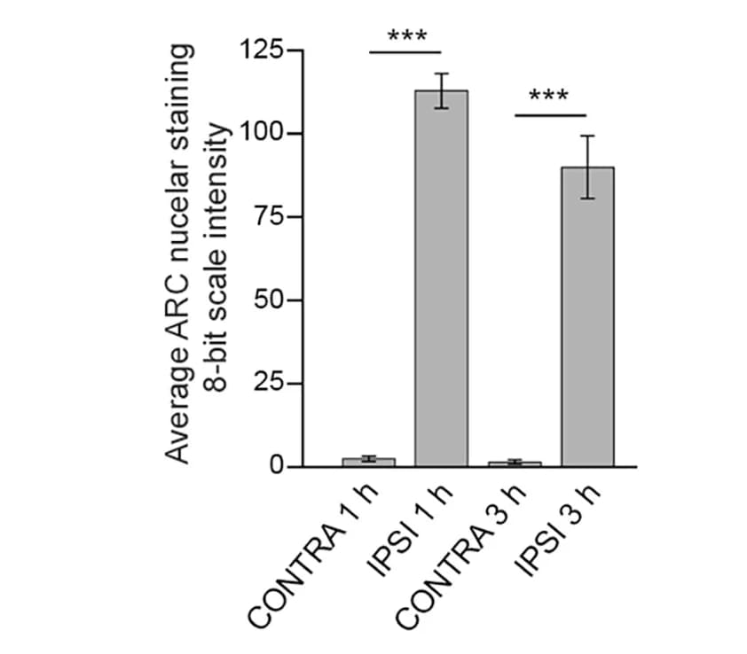 Open access visualization of Bar Plot, Error Bars, Quantitative Analysis, ARC Signal, Granule Cells