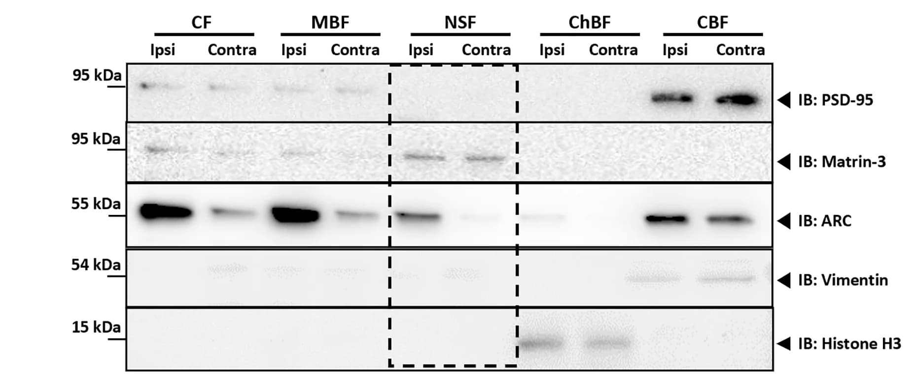Open access visualization of Gel, Immunoblot Analysis, Subcellular Fractions, Marker Proteins, PSD-95
