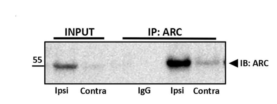 Open access visualization of Gel, Immunoblot, ARC, Nucleosol, Immunoprecipitation