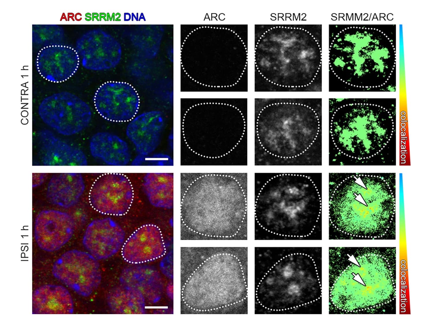 Open access visualization of Microscopy, Granule Cell, DG Control, Immunostaining, SRRM2