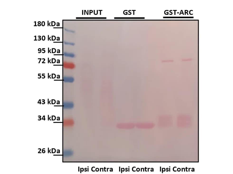 Open access visualization of Gel, GST-ARC Pull-Down, Ponceau Staining, Protein Blots, Nuclear Soluble Fraction