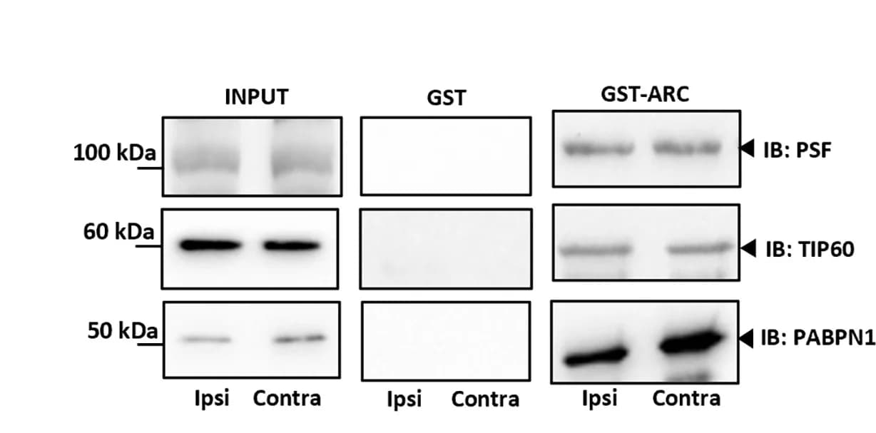 Open access visualization of Gel, Immunoblots, PSF Protein, TIP60 Protein, PABPN1 Protein