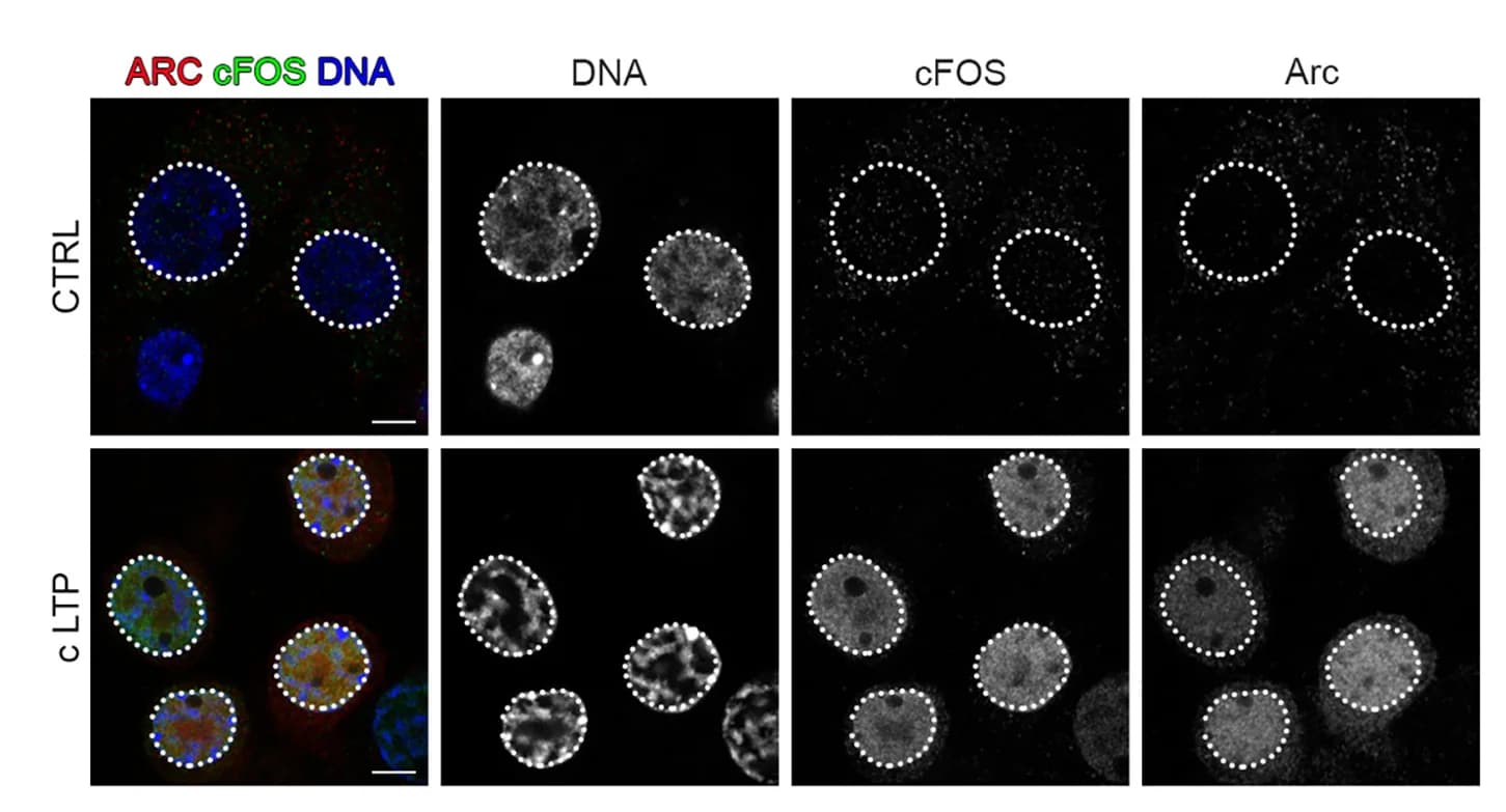 Open access visualization of Microscopy, Confocal Images, Neurons, Hippocampal Cultures, ARC