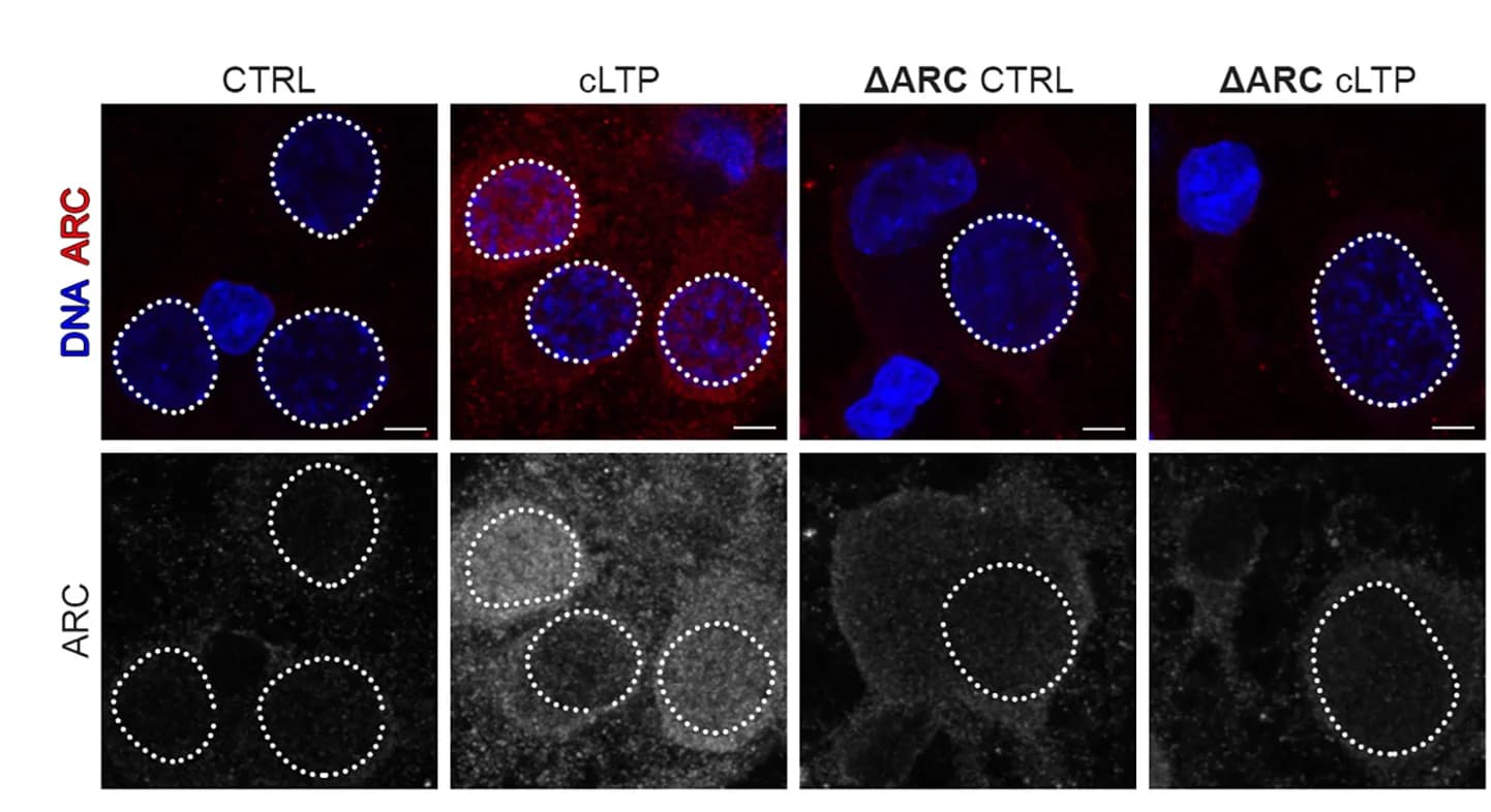 Open access visualization of Microscopy, Neuronal Cultures, shRNA, Rat Arc, LTP