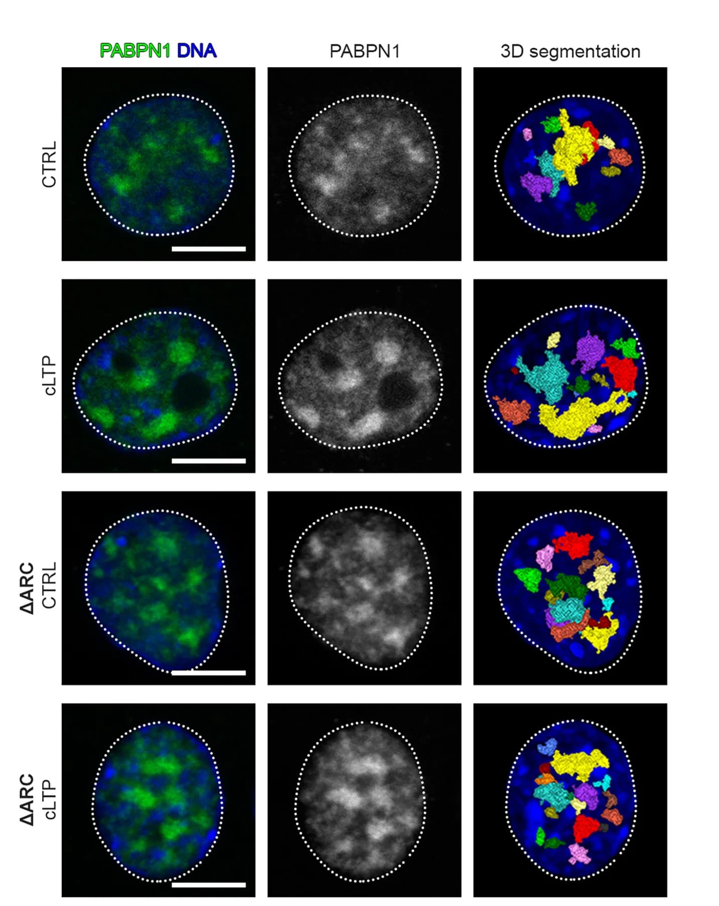 Open access visualization of Microscopy, Neuronal Nuclei, Confocal Images, PABPN1, DNA