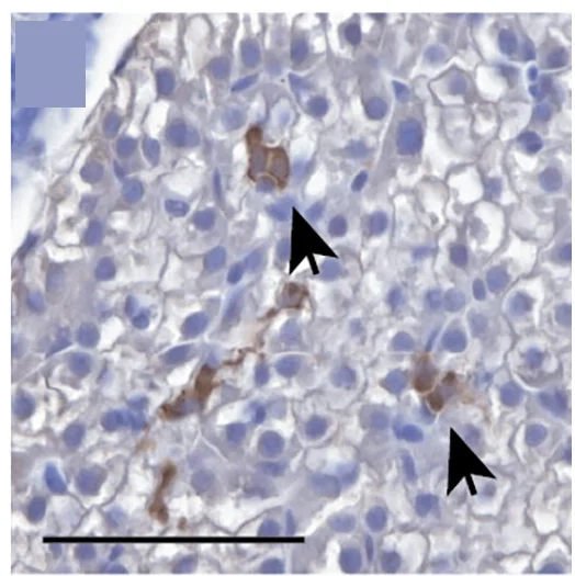 Open access visualization of Microscopy, Immunohistochemistry, Sagittal Section, EGFP, MYCN