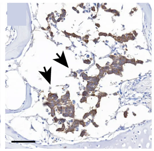 Open access visualization of Microscopy, Immunohistochemistry, Sagittal Section, EGFP, MYCN