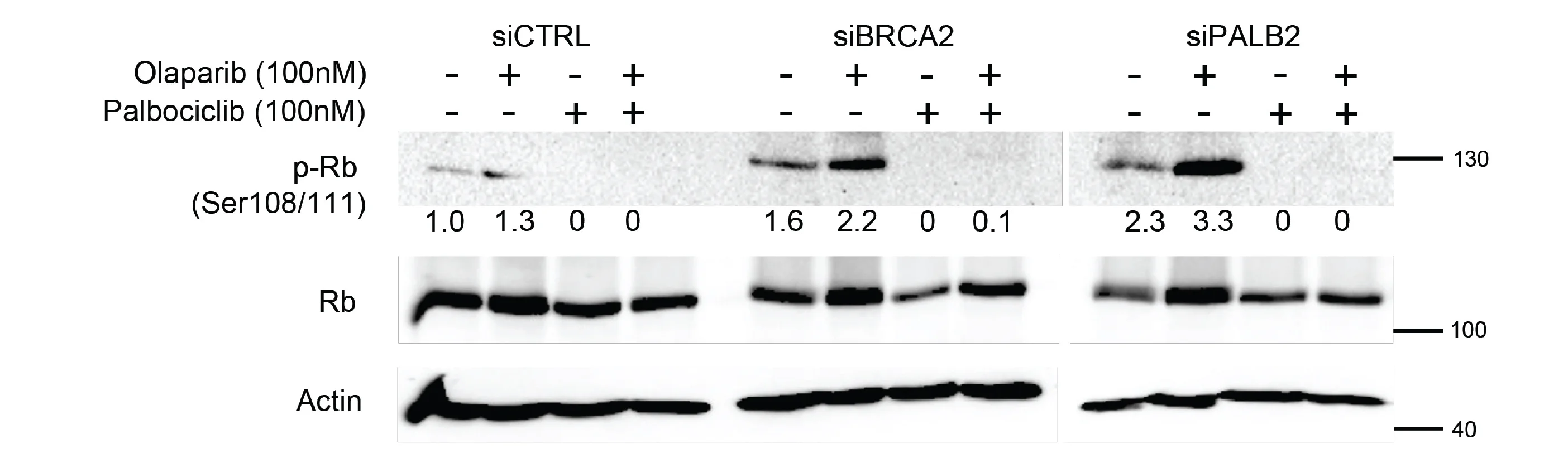 Open access visualization of Gel, Western Blot, Phosphorylated Rb, Total Rb Protein, SH-EP Cells