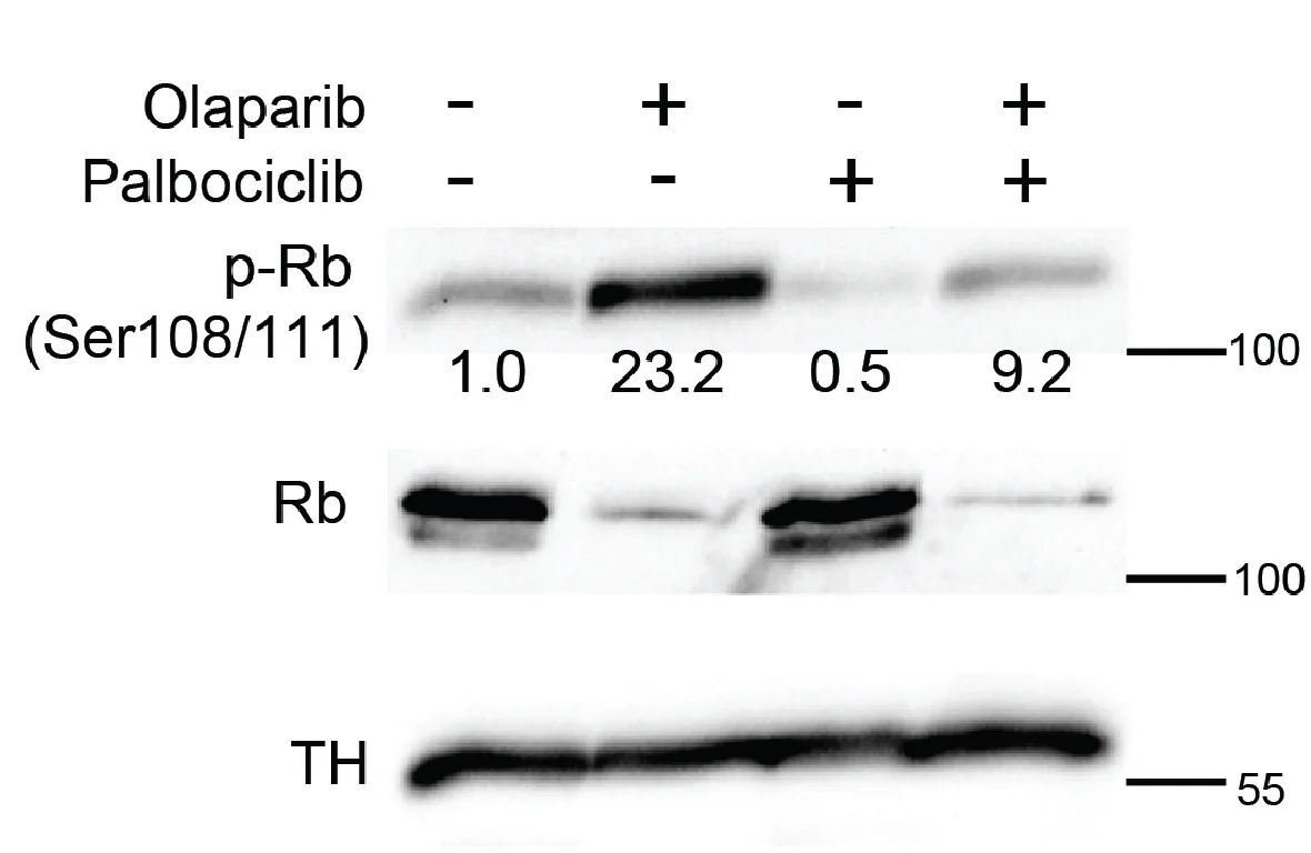 Open access visualization of Gel, Western Blot, Phosphorylated Rb, Total Rb Protein, Tyrosine Hydroxylase