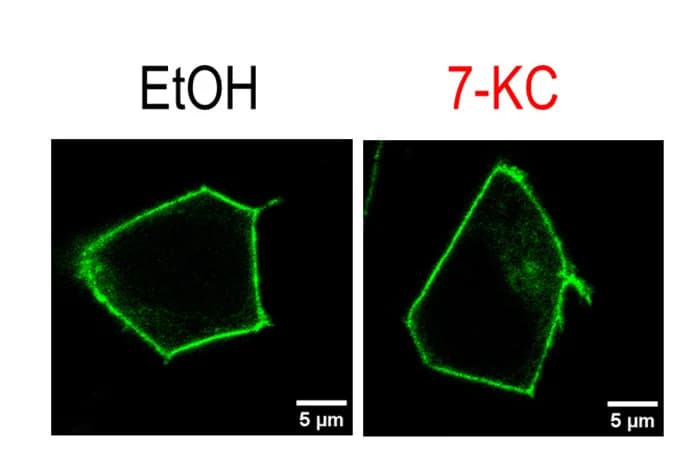 Open access visualization of Microscopy, Membrane Expression, Piezo1-GFP, EtOH, 7-KC