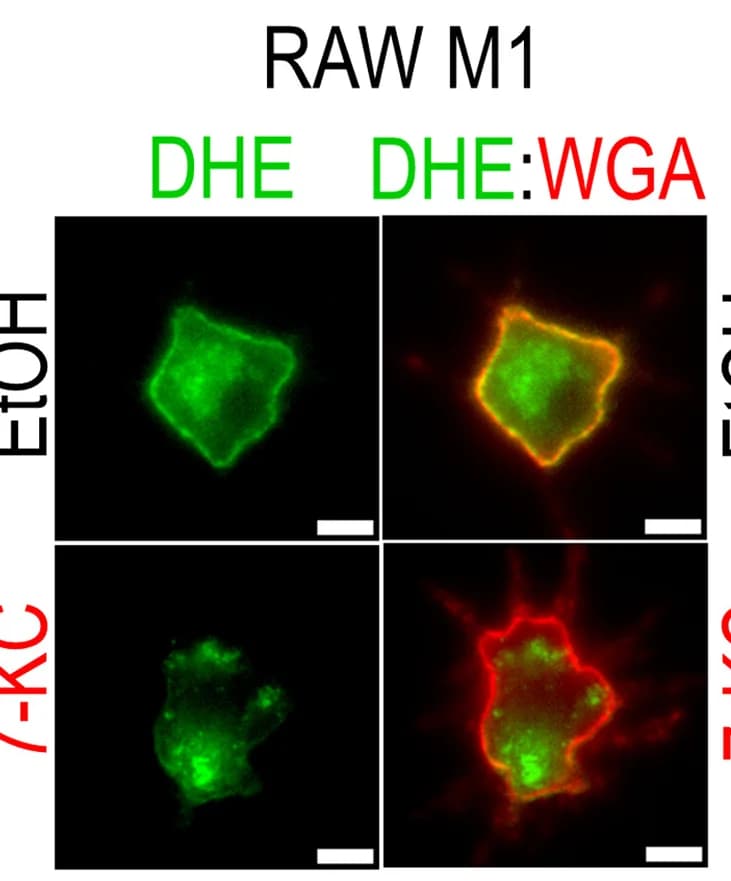 Open access visualization of Microscopy, Fluorescence Microscopy, RAW Cells, 7-KC, DHE Localization