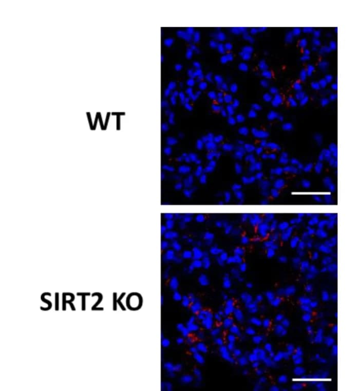 Open access visualization of Microscopy, Immunostaining, Phosphorylation of STING, Lung Sections, WT Mice