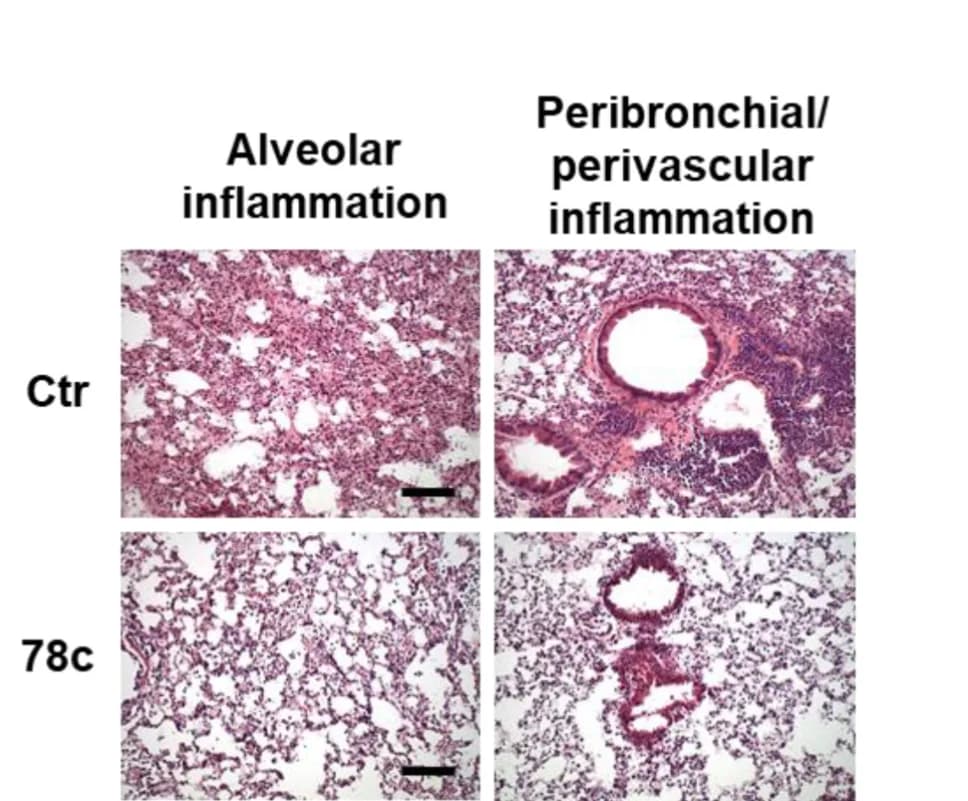 Open access visualization of Microscopy, H&E Staining, Lung Sections