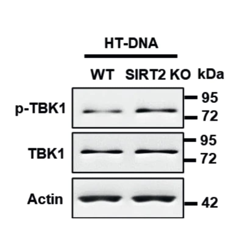 Open access visualization of Gel, Western Blot Analysis, TBK1, Phosphorylated TBK1, Actin