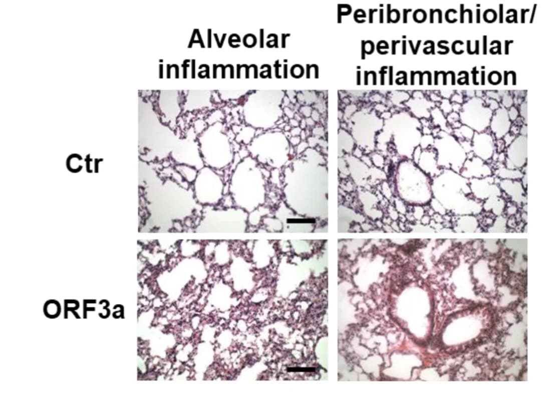 Open access visualization of Microscopy, H&E Staining, Lung Sections, Young Mice