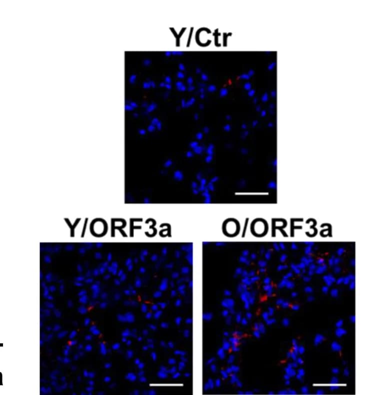Open access visualization of Microscopy, Immunostaining, Phosphorylated STING, Lung Sections, Young Mice