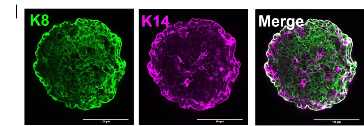 Open access visualization of Microscopy, K8, K14, AIRE, Staining
