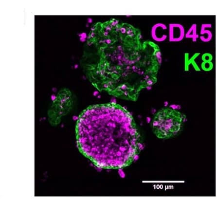 Open access visualization of Microscopy, K8, CD45, Staining