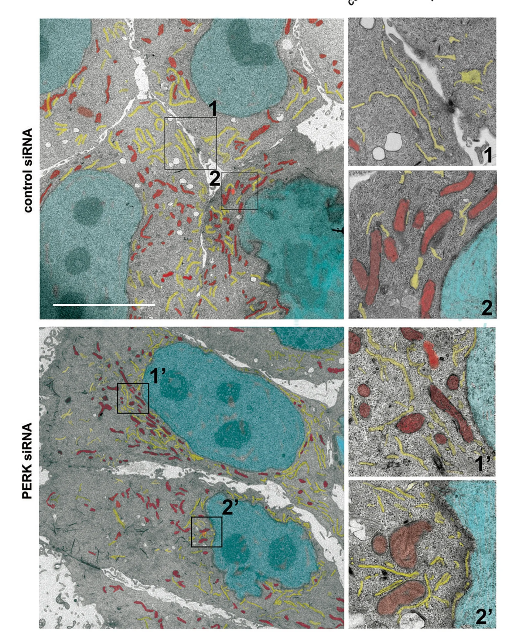 Open access visualization of Microscopy, STED Microscopy, Calreticulin, Electron Microscopy, MCF10A Cells