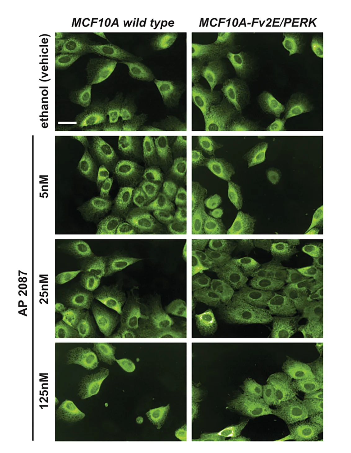 Open access visualization of Microscopy, ER Remodeling, PERK Kinase, Homodimerization, ER Stress