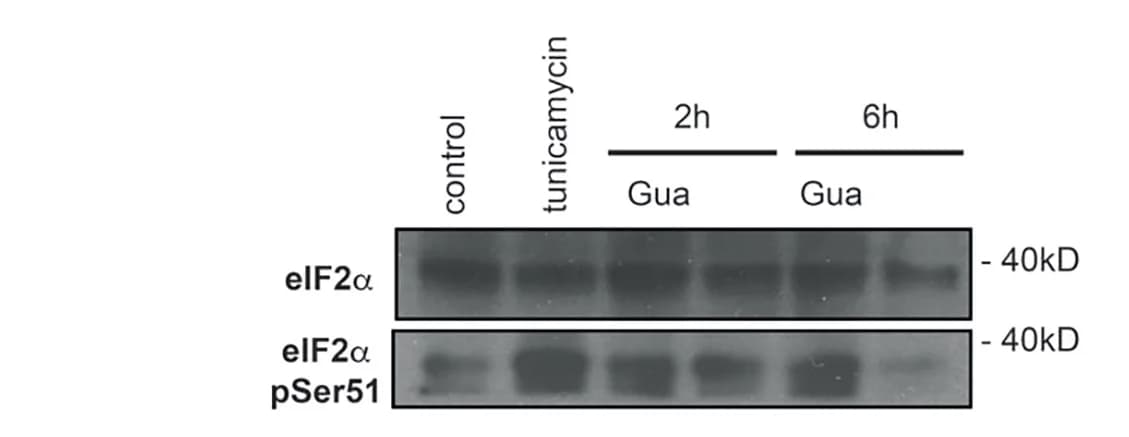 Open access visualization of Gel, MCF10A Cells, Tunicamycin, Guanabenz, Western Blot