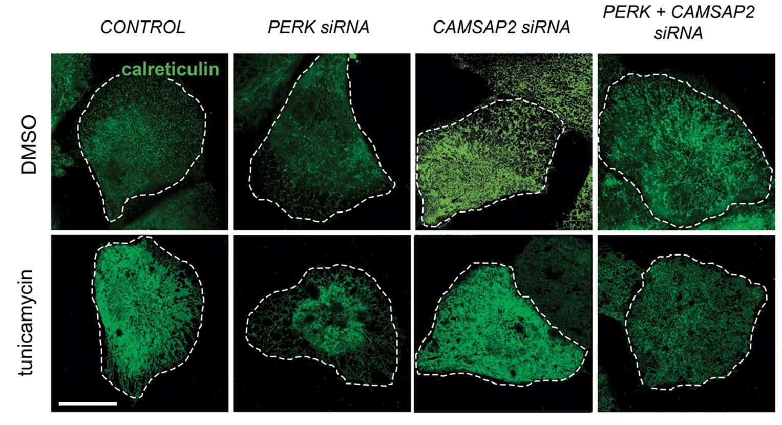 Open access visualization of Microscopy, MCF10A Cells, siRNA, Small-Compound Treatments, Quantitative Imaging