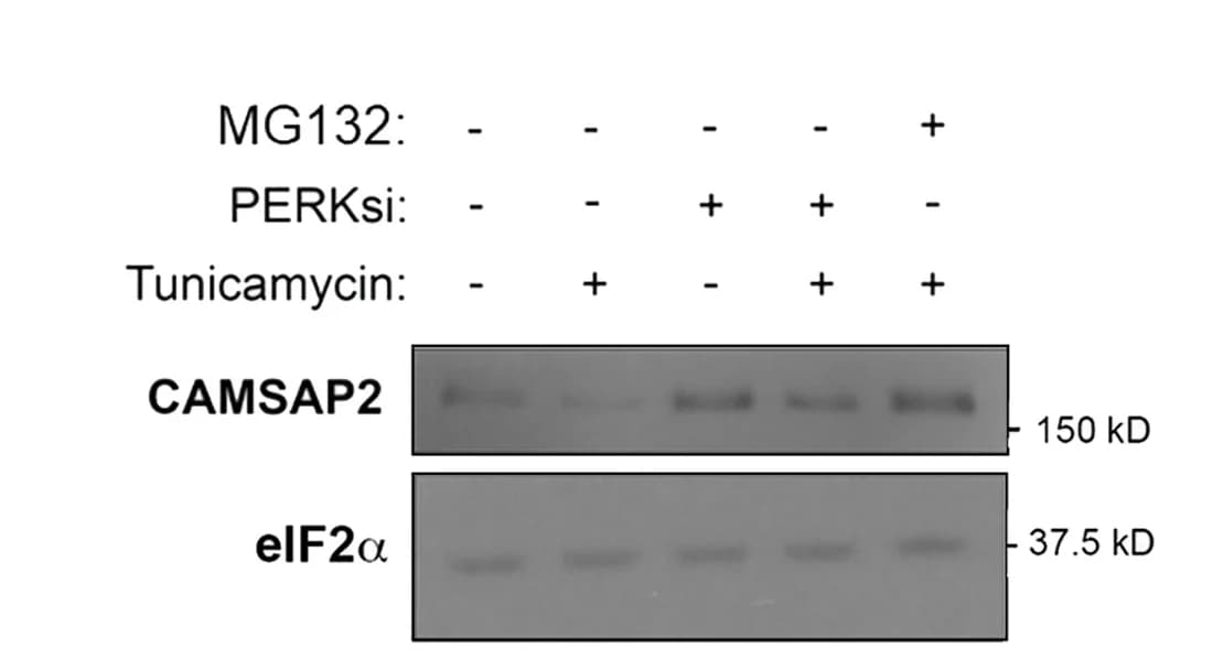 Open access visualization of Gel, MCF10A Cells, PERKsi Transfection, Tunicamycin, Western Blot