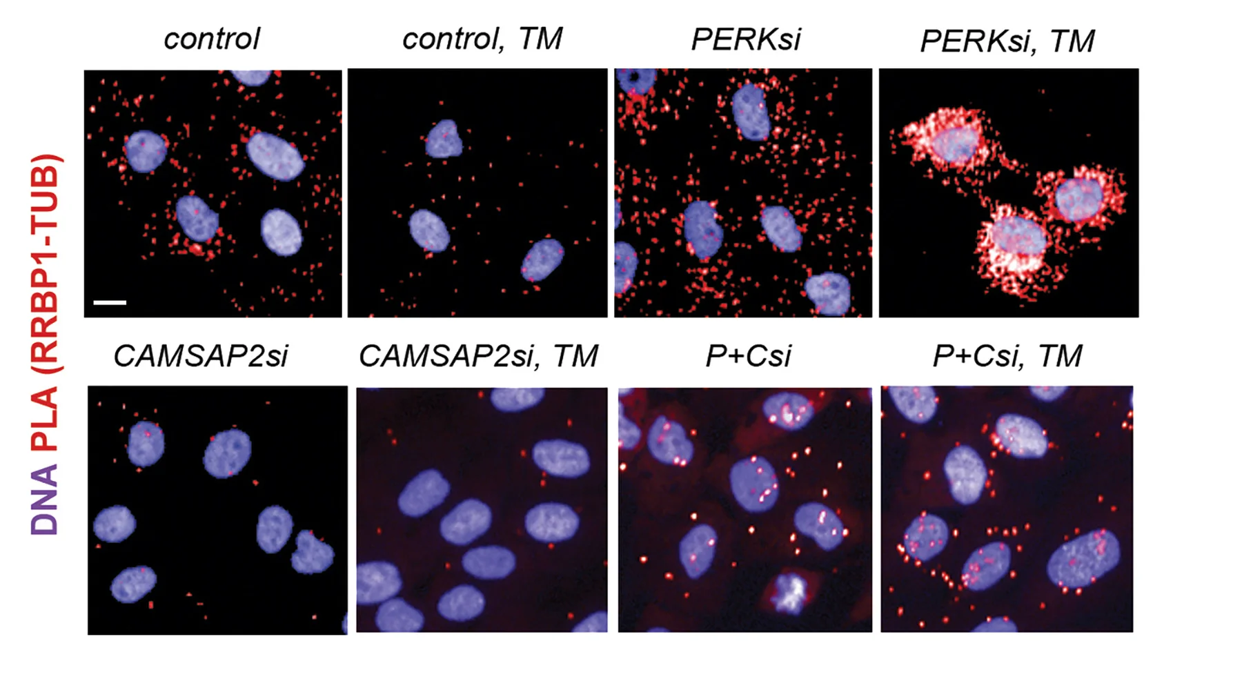 Open access visualization of Microscopy, Confocal Images, Proximity Ligation Assay, RRBP1-αtubulin Interaction, Tunicamycin