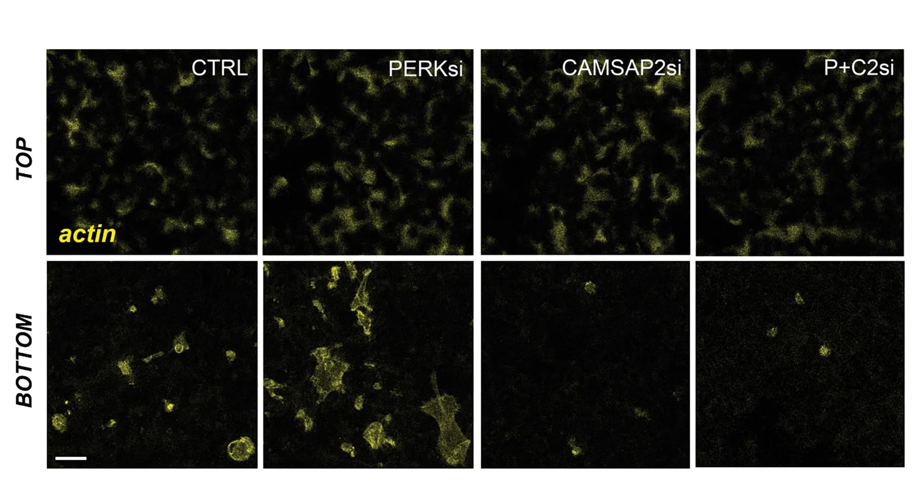 Open access visualization of Microscopy, MCF10A, siRNA Treatments, Transwell Pore Membranes, Actin Staining