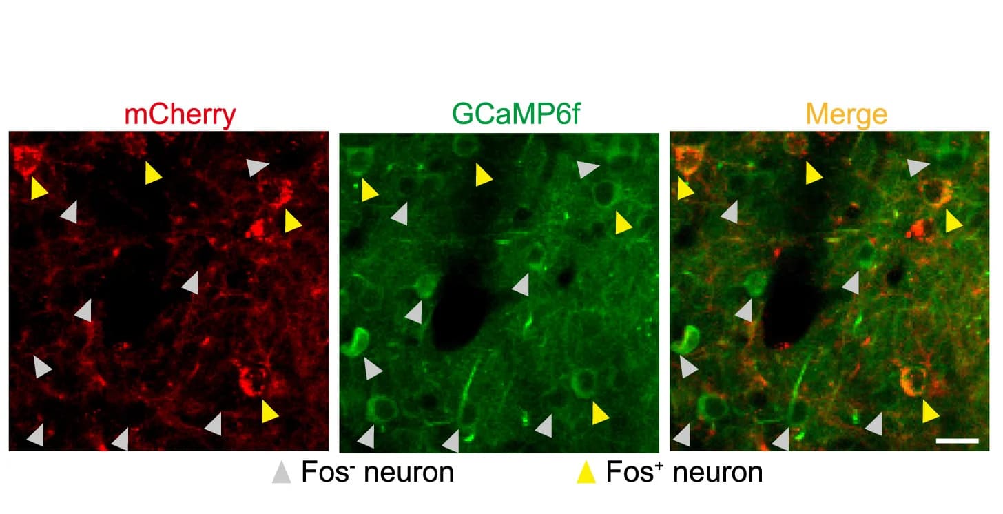 Open access visualization of Microscopy, TRAP, Fos+ Neurons, Visual Cortex