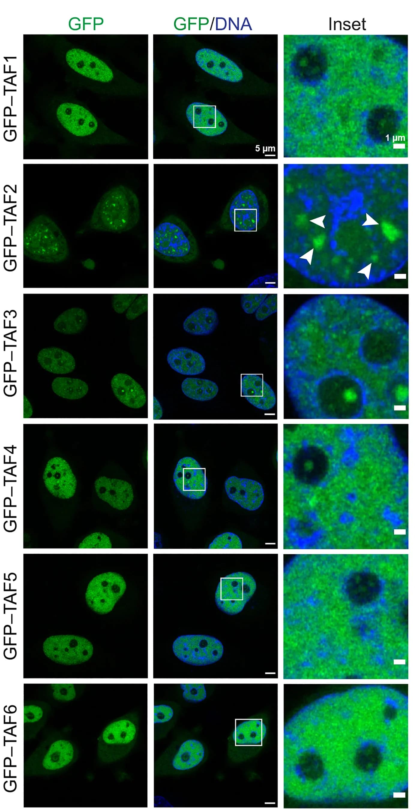 Open access visualization of Microscopy, Live-Cell Confocal Microscopy, HeLa Cells, TFIID Subunits, GFP Fusions