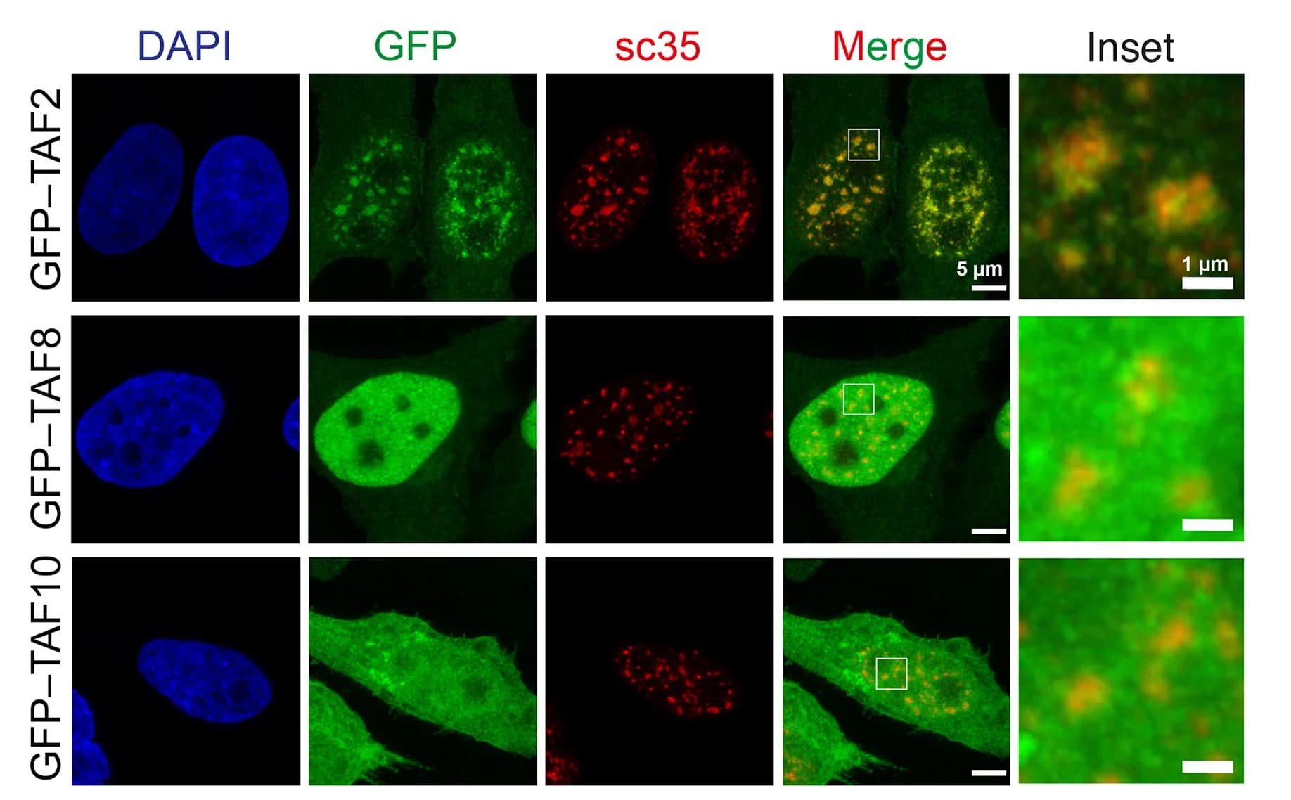Open access visualization of Microscopy, Confocal Microscopy, HeLa Cells, TFIID Subunits, GFP Fusions