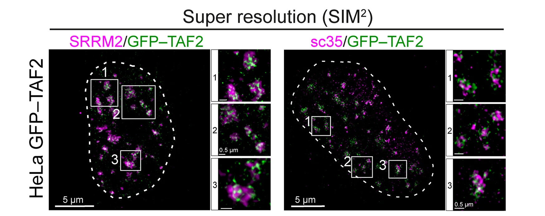 Open access visualization of Microscopy, Super-resolution Microscopy, GFP, TAF2, HeLa Cells
