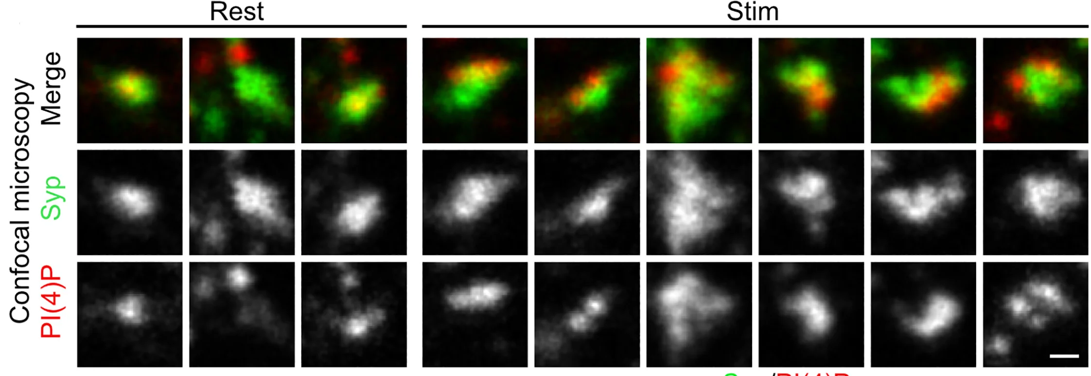 Open access visualization of Microscopy, Immunofluorescence, Syp, PI(4)P, Resting Condition