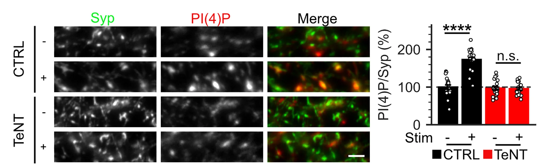 Open access visualization of Bar Plot, Microscopy, Scatter Plot, Immunostaining, PI(4)P