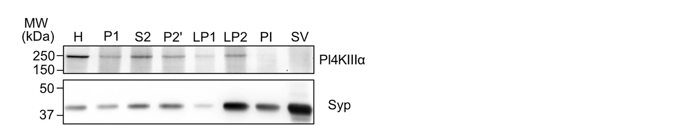 Open access visualization of Gel, Western Blot Analysis, PI4KIIIα, SV-Enrichment Profiles, Anti-Syp Antibody