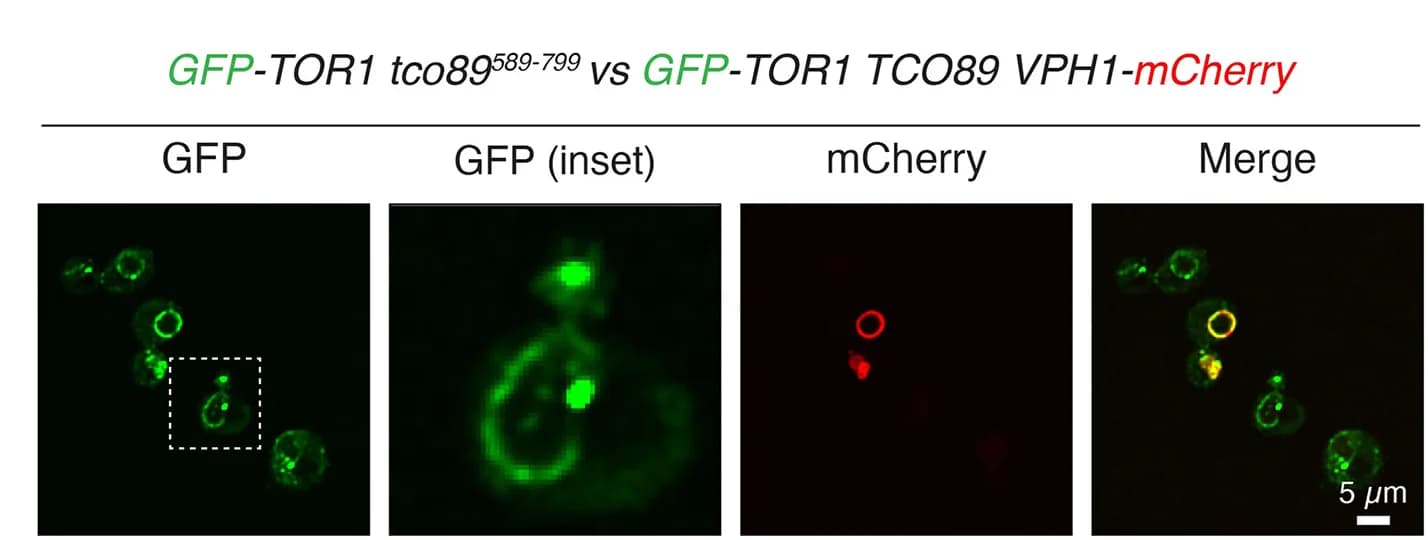 Open access visualization of Microscopy, GFP-Tor1, Yeast Cells, Tco89585-799, Tco89