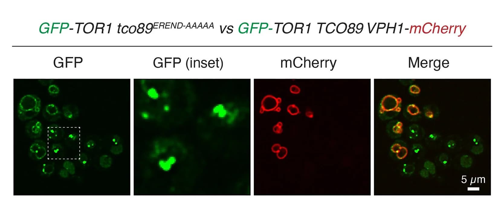 Open access visualization of Microscopy, GFP-Tor1, Localization, tco89EREND-AAAAA, TCO89