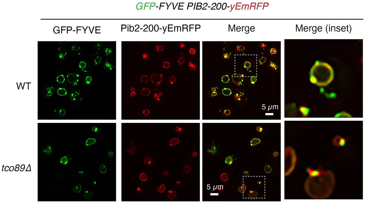 Open access visualization of Microscopy, Pib2, GFP-FYVE, Signaling Endosomes, Tco89